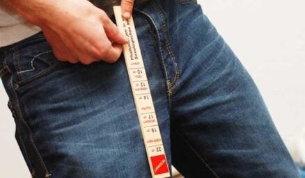 MEASUREMENT OF PENIS SIZE