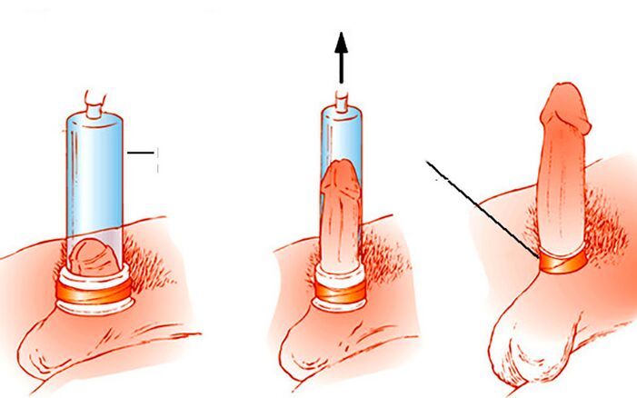 How the pump works
